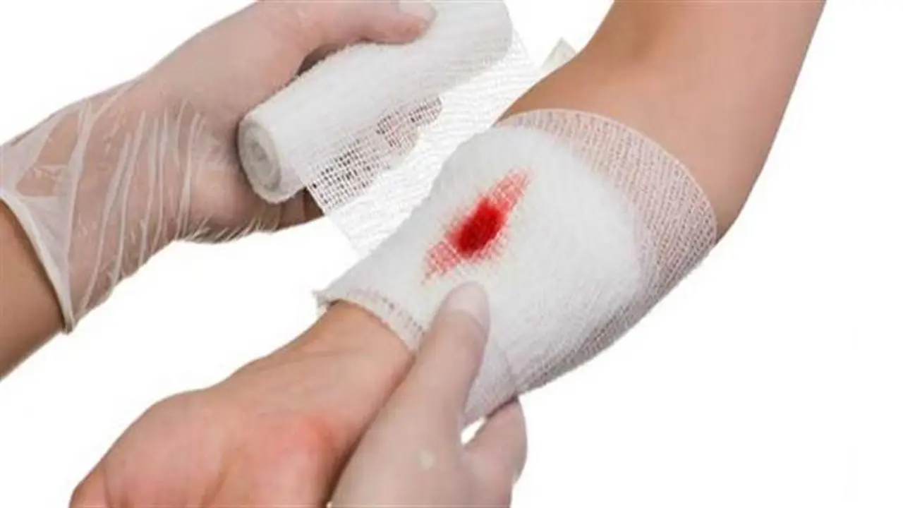 تنظيف الجروح آمنًا في المنزل: 5 خطوات فعالة بعد سحب مطهر الجروح من السوق